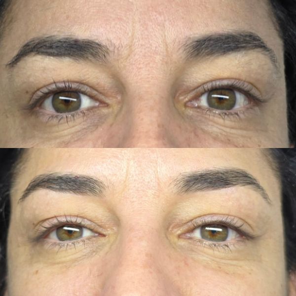 Spa Facial Vera